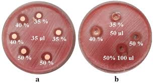 Wählen sie aus einer vielzahl ähnlicher szenen aus. Streptococcus Mutans Culture Inhibition Diameters When Inoculating 35 Download Scientific Diagram