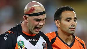 Concussion rules under scrutiny as Wests Liam Fulton suffers another head  knock