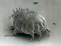 Image result for Sarcoptes scabiei