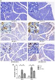 Maybe you would like to learn more about one of these? Resveratrol Protects Against L Arginine Induced Acute Necrotizing Pancreatitis In Mice By Enhancing Sirt1 Mediated Deacetylation Of P53 And Heat Shock Factor 1
