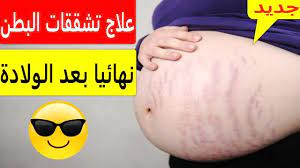 افضل ثلاث طرق تستخدم في السيلوليت و تقضي على تشققات البطن والترهلات والخيوط sports ale