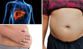 Producing bile, a solution that helps digest fats and eliminate waste products. Liver Cancer Symptoms Ascites Could Indicate The Deadly Disease What Is It Express Co Uk