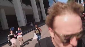 Make ugly hairline memes or upload your own images to make custom memes. Logan Paul S Hairline Lipstick Alley