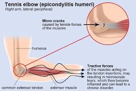 Pin On Health Problems