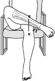 Image result for Crossed-Leg Test