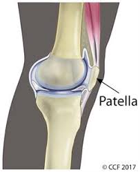 The reported incidence of patellar problems after total knee replacement has ranged from 5 to 30 per cent. Knee Pain Chondromalacia Patella Causes Symptoms Treatment