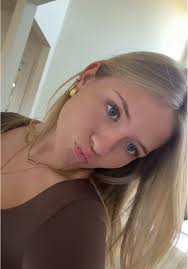 Anna Somers Post Fight