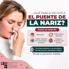 👨🏻‍⚕️ ¿Te duele el puente de la nariz? No es algo que debas ignorar.  Podría ser desde una simple inflamación hasta una infección o problema en  los senos paranasales. 👉🏻 Si el