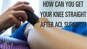 Sep 12, 2019 · the acl graft, the new ligament, is attached at a steeper angle, which can not only cause rotational instability in the knee but can also disrupt the normal sense of proper position. How Can I Get My Knee Straight After Acl Surgery Youtube
