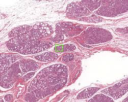 Female Reproductive System Histology Histology of vas/ ductus deferens in testes. female reproductive system histology
