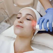 Should I choose dermalase for pico laser treatment?