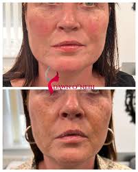 Dawn ONeill Aesthetics