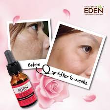 Soothing toner 100ml x 1 bottle< 3. Garden Of Eden Rosa E Pigmentation Serum 15ml Alpro Pharmacy