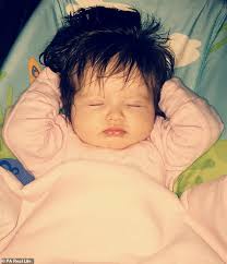 Hair transplants involve a doctor moving hair from one spot of your body to the thinning area of your scalp. Mother Of Two Was Shocked When Daughter Was Born With Thick Jet Black Hair Readsector