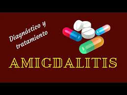 Amigdalitis Diagnostico Y Tratamiento Youtube