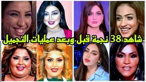 ‫شاهد 38 فنانة قبل وبعد عمليات التجميل وشاهد ظهور صادم للفنانة نادية الجندي  قبل عمليات التجميل 👉💥 - YouTube‬‎
