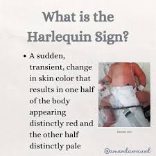 Image result for Harlequin Color Change