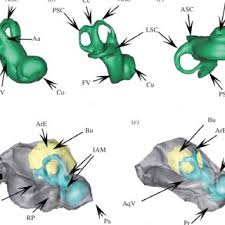 The trautmann's triangle was often hidden medially to the sigmoid sinus and the ps canal (the anterior border of trautmann's triangle) was barely detectable, in the lateral group. Qualitative Analysis Of Trautmann S Triangle In The Lateral Group A Download Scientific Diagram