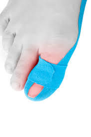Your pinky toe may be small — but if it gets injured it can hurt big time. Health Hack How To Treat A Broken Toe At Home University Of Utah Health