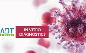 Official reference contact is from malaysia original bill of ladings, including email, phone. Adt Biotech Launches Kit For Detection Of Sars Cov 2