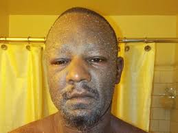 Fundraiser by Keisha Butler : Help For Taj as he fight for Stem Cell  Transplant