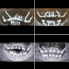 Dentist Fort Worth & Amarillo