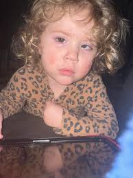 My 23 year old sister woke up with orange staining