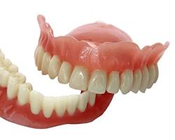 What are the types of Dental Treatment?