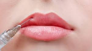 Cosmetic fillers are long lasting, but not permanent. Amazon And Ebay Selling Self Inject Filler Kits