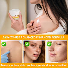 Amazon.com: Bee Venom Crema de tratamiento de la piel, crema hidratante  profesional de veneno de abeja para piel seca, crema reparadora de veneno  de abeja natural para todo tipo de piel, 3.5