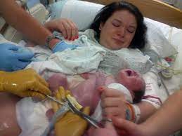 When You Should Cut Your Baby S Umbilical Cord