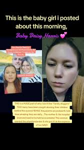 Daisy Getting Bruises by Her Mom and Her Dad