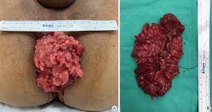 Annals of Coloproctology