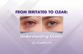 Image result for Uveitis