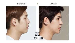 Pin On Before And After Photos