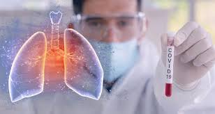 Datos básicos que debes saber sobre el coronavirus y COVID-19 ...