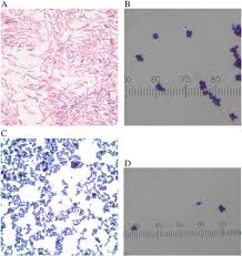 Listeria monocytogenes in gram stain showing gram positive coccobacillus, small gram rod to large rod and also in groups resembling diphtheroids.#listeria#. Identification Of Non Listeria Spp Bacterial Isolates Yielding A B D Glucosidase Positive Phenotype On Agar Listeria According To Ottaviani And Agosti Aloa Sciencedirect
