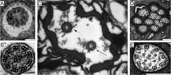 Ein paar, fünf davon waren sie verheiratet. 1001 Model Organisms To Study Cilia And Flagella Vincensini 2011 Biology Of The Cell Wiley Online Library