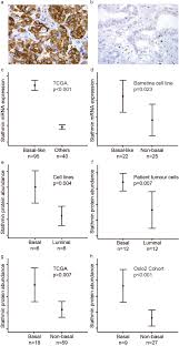 Cancer patients who are weak need special cancer treatments. Stathmin Expression Associates With Vascular And Immune Responses In Aggressive Breast Cancer Subgroups Scientific Reports