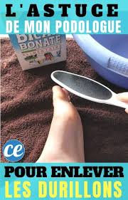 Et si on la laisse, elle peut même être douloureuse. Durillons Aux Pieds Le Remede Miracle Revele Par Mon Podologue Durillon Soin Des Pieds Cor Au Pied