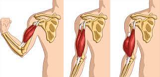 Biceps Tendonitis | Metro Physio