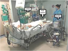 Decreased use of neonatal extracorporeal membrane oxygenation (ecmo): Successful Rescue Combination Of Extracorporeal Membrane Oxygenation High Frequency Oscillatory Ventilation And Prone Positioning For The Management Of Severe Methicillin Resistant Staphylococcus Aureus Pneumonia Complicated By Pneumothorax A Case