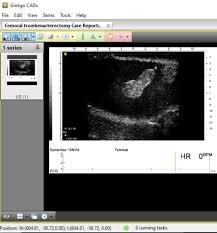 Aimed at displaying images in a web page or patient cd. 6 Best Free Open Source Dicom Viewer Software For Windows