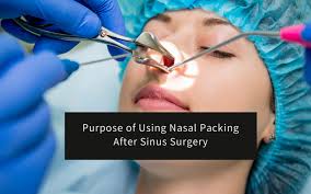 Image result for Nasal Packing