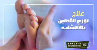 علاج تورم القدمين بالاعشاب