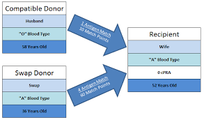 compatible pairs national kidney registry facilitating