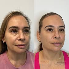 𝗧𝗥𝗨𝗘 𝗘𝗦𝗦𝗘𝗡𝗖𝗘 𝗔𝗲𝘀𝘁𝗵𝗲𝘁𝗶𝗰𝘀 (@trueessenceaesthetics) ·  Chino Hills, CA