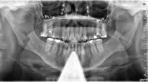 Do You See Anything Wrong With This X Advanced Prostate