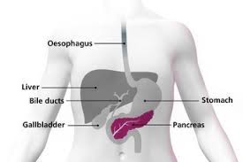 May 31, 2018 · people with pancreatic cancer generally only start to display symptoms when the tumor becomes large enough to interfere with its neighboring organs. What Is Pancreatic Cancer Nhs