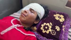 Shrapnel robs Gaza girl of vision and hope for the future